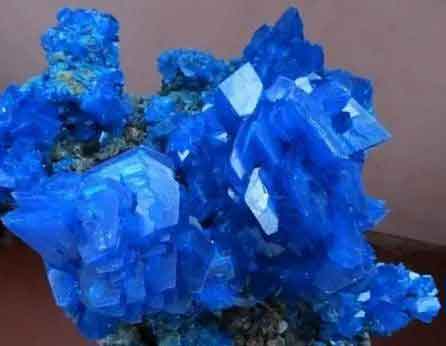 Bile crystals Bile crystals